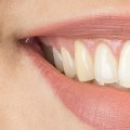 7 Tips for Teeth Whitening: Expert Advice from Dentists