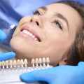 The Benefits of Professional Teeth Whitening