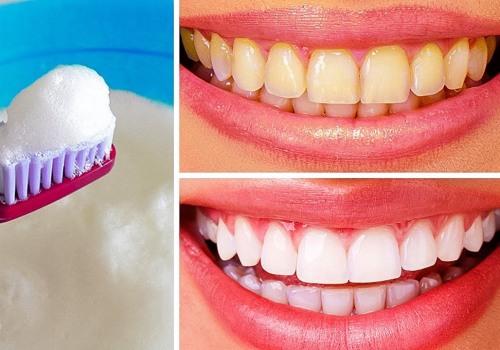 The Most Effective Ways to Whiten Teeth at Home