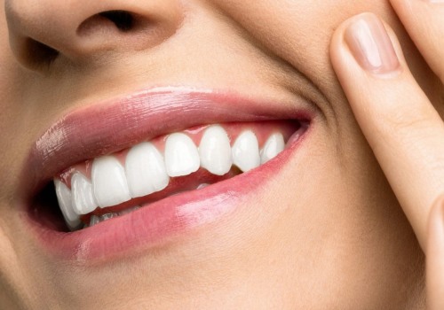 Everything You Need to Know About Teeth Whitening