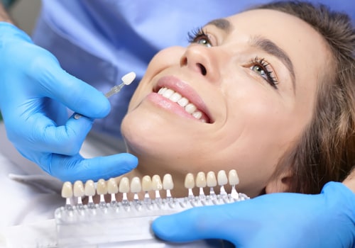The Benefits of Professional Teeth Whitening